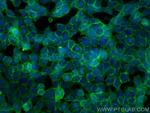 E-cadherin Antibody in Immunocytochemistry (ICC/IF)