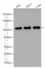 E-cadherin Antibody in Western Blot (WB)