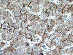 E-cadherin Antibody in Immunohistochemistry (Paraffin) (IHC (P))