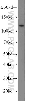 E-cadherin Antibody in Western Blot (WB)