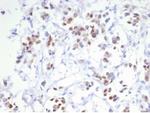 Estrogen Receptor, alpha (Marker of Estrogen Dependence) Antibody in Immunohistochemistry (Paraffin) (IHC (P))