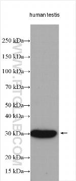 ANKRD7 Antibody in Western Blot (WB)