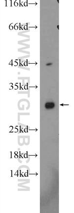 ANKRD7 Antibody in Western Blot (WB)