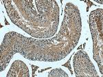 ACE2 Antibody in Immunohistochemistry (Paraffin) (IHC (P))