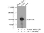 ACE2 Antibody in Immunoprecipitation (IP)