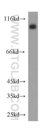 ACE2 Antibody in Western Blot (WB)