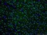 S1PR2 Antibody in Immunohistochemistry (PFA fixed) (IHC (PFA))