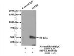 S1PR2 Antibody in Immunoprecipitation (IP)