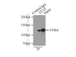 TET2 Antibody in Immunoprecipitation (IP)