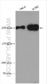 TET2 Antibody in Western Blot (WB)