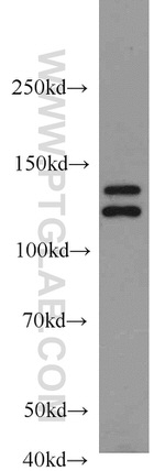 TET2 Antibody in Western Blot (WB)