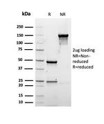 Albumin (Transport Protein) Antibody in SDS-PAGE (SDS-PAGE)