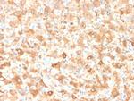 Albumin (Transport Protein) Antibody in Immunohistochemistry (Paraffin) (IHC (P))