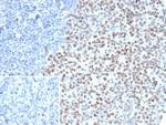 EZH2/KMT6 Antibody in Immunohistochemistry (Paraffin) (IHC (P))