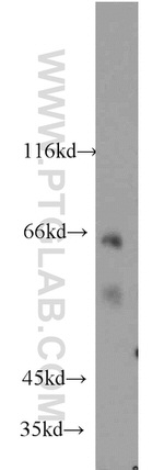 VANGL2 Antibody in Western Blot (WB)