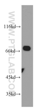 Arp5/ACTR5 Antibody in Western Blot (WB)