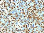 Factor XIIIa (Coagulation Factor XIIIA Chain) Antibody in Immunohistochemistry (Paraffin) (IHC (P))