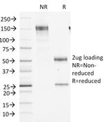 Factor XIIIa (Coagulation Factor XIIIA Chain) Antibody in SDS-PAGE (SDS-PAGE)