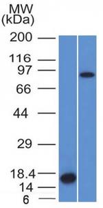 Factor XIIIa (Coagulation Factor XIIIA Chain) Antibody in Western Blot (WB)