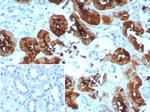 Fatty Acid Binding Protein (Liver)/FABP1 Antibody in Immunohistochemistry (Paraffin) (IHC (P))