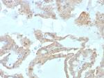 FABP2 (Marker of Metastatic Potential in Colorectal Cancer) Antibody in Immunohistochemistry (Paraffin) (IHC (P))