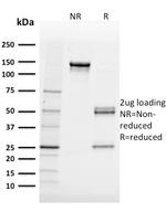FABP5 Antibody in SDS-PAGE (SDS-PAGE)