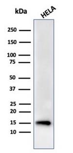 FABP5 (Marker of Metastatic Potential in Colorectal Cancer) Antibody in Western Blot (WB)
