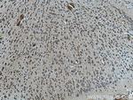 L-VOCC Antibody in Immunohistochemistry (Paraffin) (IHC (P))