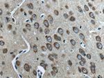 L-VOCC Antibody in Immunohistochemistry (Paraffin) (IHC (P))