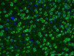 L-VOCC Antibody in Immunohistochemistry (PFA fixed) (IHC (PFA))