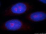 ZNF74 Antibody in Immunocytochemistry (ICC/IF)