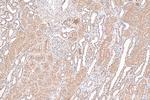 NR3C2 Antibody in Immunohistochemistry (Paraffin) (IHC (P))