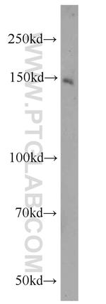 ZNF541 Antibody in Western Blot (WB)