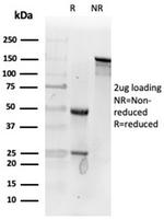 Fibroblast Activation Protein Alpha/FAP-1 Antibody in SDS-PAGE (SDS-PAGE)