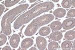 USH1G Antibody in Immunohistochemistry (Paraffin) (IHC (P))