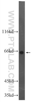 DDX56 Antibody in Western Blot (WB)