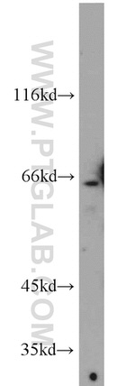 DDX56 Antibody in Western Blot (WB)