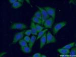 PKC alpha Antibody in Immunocytochemistry (ICC/IF)