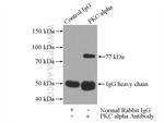 PKC alpha Antibody in Immunoprecipitation (IP)