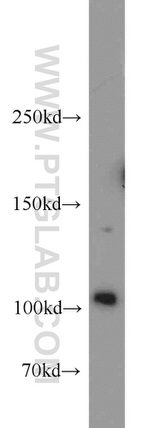 Hexokinase 2 Antibody in Western Blot (WB)