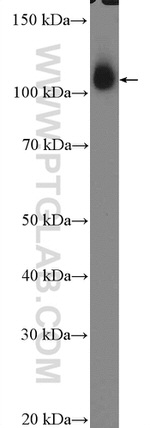 Hexokinase 2 Antibody in Western Blot (WB)