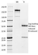 CD32 (Fc Gamma RIIa) Antibody in SDS-PAGE (SDS-PAGE)
