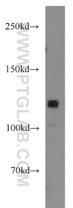 GRIP1 Antibody in Western Blot (WB)