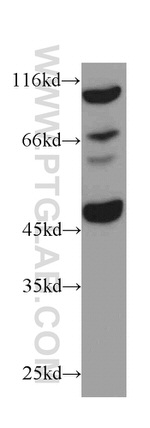 C9orf72 Antibody in Western Blot (WB)