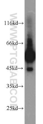 C9orf72 Antibody in Western Blot (WB)