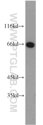 HSF4 Antibody in Western Blot (WB)