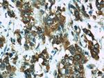 Osteopontin Antibody in Immunohistochemistry (Paraffin) (IHC (P))