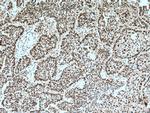 PARP1 Antibody in Immunohistochemistry (Paraffin) (IHC (P))