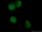 PARP1 Antibody in Immunocytochemistry (ICC/IF)