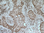 PARP1 Antibody in Immunohistochemistry (Paraffin) (IHC (P))